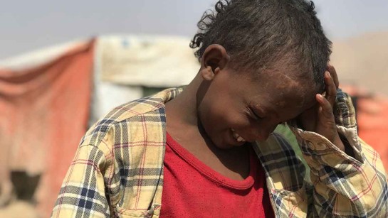 7-åriga Fuad är på flykt från sitt hem. Han har nyligen opererats för en skada på huvudet. Han bor i tältläger mitt i krigets Jemen.