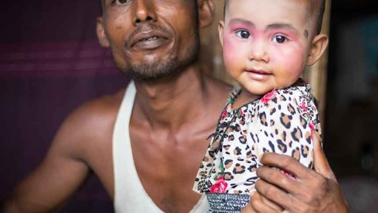 En pappa och hans barn tillhör den statslösa folkgruppen Rohingya i Burma (Myanmar).