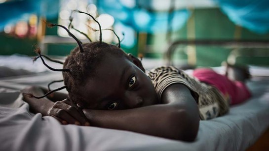 En flicka på flykt från konfliktdrabbade Centralafrikanska republiken vilar i en sjuksäng på en av UNHCR:s kliniker i Inke-lägret, Demokratiska republiken Kongo. &#039;Jag är här idag för att jag har feber, under tiden jag har varit i lägret har min pappa dött. Idag är jag här med min mamma&#039; berättar Jemima Yama, 10 år. 
